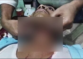 Young Man's Throat Cut With Chinese Manja