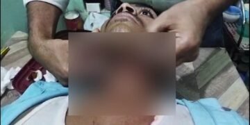 Young Man's Throat Cut With Chinese Manja