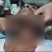 Young Man's Throat Cut With Chinese Manja