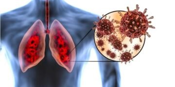 Lungs of Indians became weak after Corona